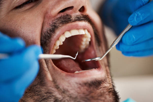 Best Walk-In Emergency Dentist in Kingston, PA