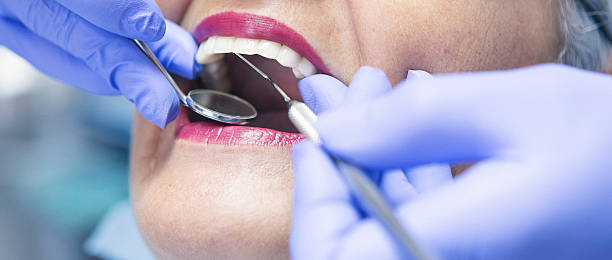Best Emergency Treatment for Toothache in Kingston, PA